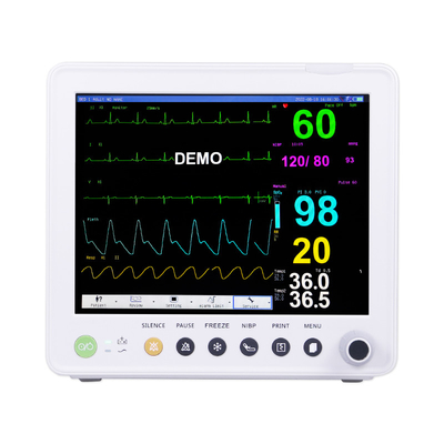 Máy theo dõi bệnh nhân di động với các thông số của ETCO2 ECG NIBP SPO2 RESP TEMP PR