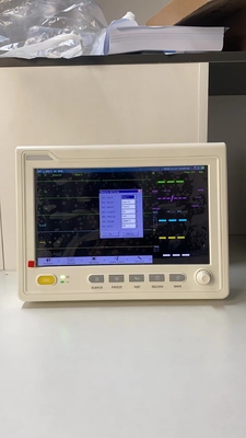 ICU Multiparameter Bệnh nhân theo dõi bệnh viện xe cứu thương thiết bị di động dấu hiệu quan trọng theo dõi