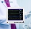 Màn hình bệnh nhân đa thông số đáng tin cậy PM-9000 Xe hàng di động tùy chọn 15 inch